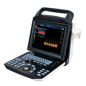 Laptop Cardiac Ultrasound