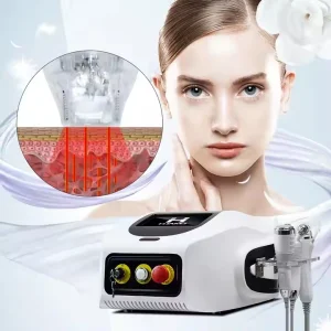 Fractional RF Microneedle Acne Treatment Facial