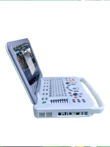 Advanced Veterinary Color Ultrasound System for Animal Health Monitoring