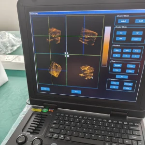 Sistema Cardíaco 4D