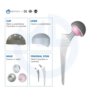 Orthopedic Implants Titanium Hip Prosthesis Replacement Devices Cementless Femoral Stem