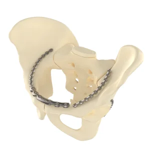 CANWELL Trauma Locking Plate Pelvic Plates 3.5mm Curved Bone Reconstruction Plate Orthopedic Implant Stainless Steel AO Standard