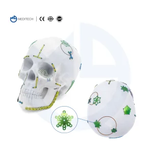 Titanium Mesh Self-Drilling Screw