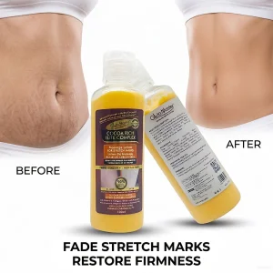 GLuta Master Stretch Marks Body Lotion Nourishing Skin Organic Enriched with Vitamin E Reduce the Appearance of Fine Lines