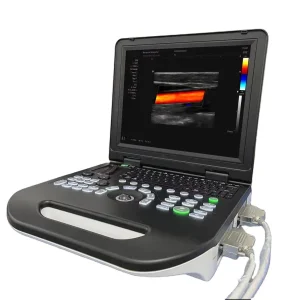 Sistema Doppler Color Portátil