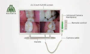 Full HD Intraoral Camera 21.5 Inch