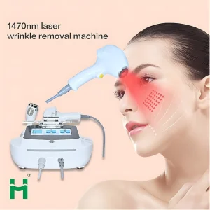 1470nm Laser