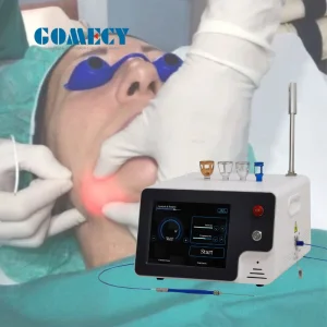 Gomecy Laser Liposuction Machine 1470nm Endolifting Diode Laser Face Lifting