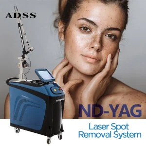 Fg2014 ND YAG Laser Tattoo Removal Machine