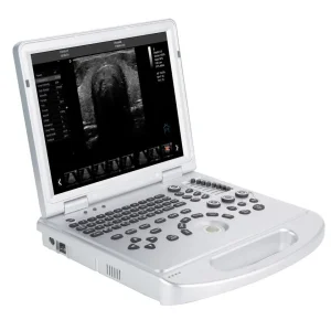 Máquina de ultrasonido médico portátil con Doppler color digital para el embarazo 3D/4D