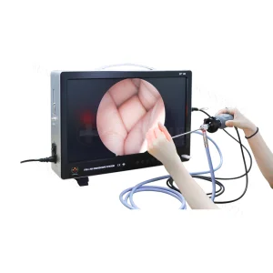 Integrated Medical Portable Endoscopy Imaging System All in One Endoscopy HD Camera Clinical Analytical Instruments