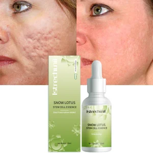 Snow Lotus Serum