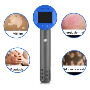 Peninsula Scalp Psoriasis Treatment Device