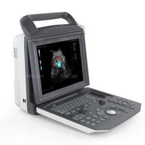Máquina de ultrasonido cardíaco inalámbrica con pantalla táctil Doppler barata 3D portátil