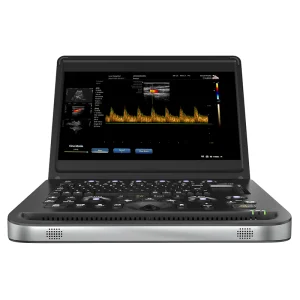 Doppler portátil barato
