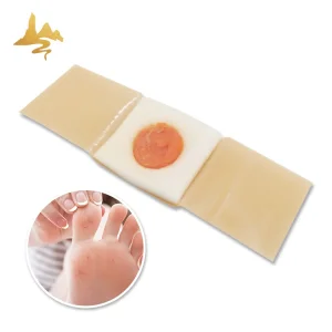 China Factory Price Foot Care Pain Relief Patch Salicyl Acid Corn Wart Removal Plaster