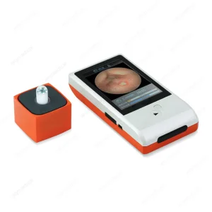 Wireless Pillcam