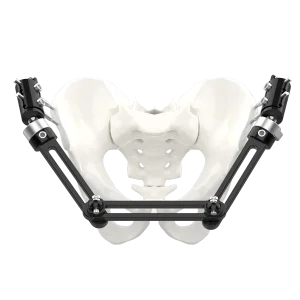 CANWELL Large External Fixation System Pelvic Frame Modular Construction Pelvic Ring Fractures Arthrodesis Osteotomies CE
