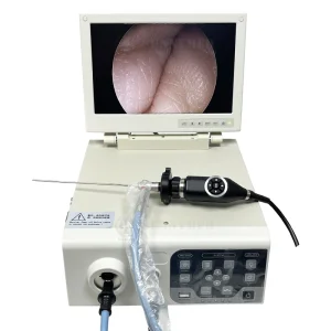 Sy-P033-2 Hospital Clinic Medical HD Monitor Endoscopy Camera System