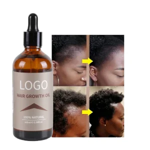 Wholesale Organic Ginger Onion Castor Rosemary African Fast Hair Growth Oil For Black Women Private Label