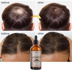 OEM High Quality Hair Growth Oil