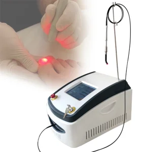 980nm diode laser nails fungus treatment