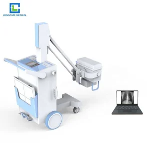 Yhx5100 Cost-Effective High Frequency Mobile Digital X-ray Equipment for Hospital Radiography Department