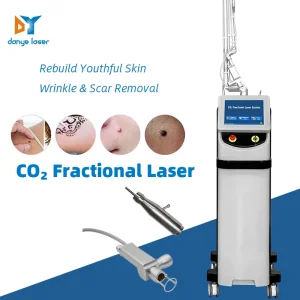 Berlin Vaginal Laser