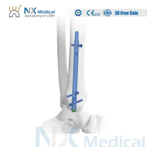 Nax Medical Nail