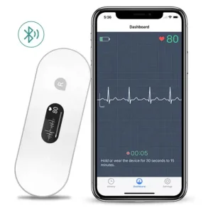 EKG Mobile