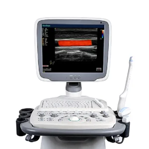 Hospital Medical Mobile Sonoscape S11 Color Doppler Ultrasound Equipment Machine