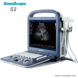 Equipo Veterinario de Hospital S2 Máquina de Ultrasonido Doppler Color Portátil