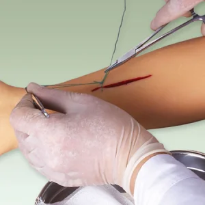 Siny Sterile Surgical Supplies Nylon Suture Suturing Kit