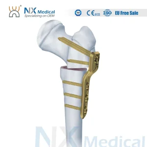 Pediatric Locking Plate