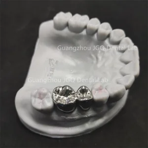 Titanium Alloy Crowns
