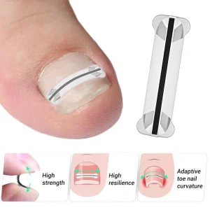 Professional home care for ingrown toenail treatment