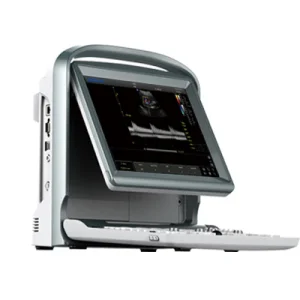 Máquina de ultrasonido portátil Doppler color LED de Chison Medical