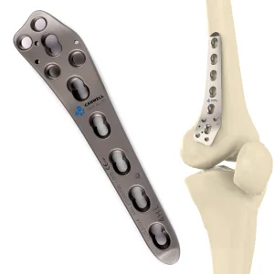 Femoral Plate