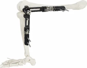 Clinical Application Fixator