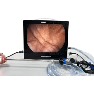 15inch Endoscopy Camera Full HD Endoscope System for Laparoscopy Uroscopy Ent
