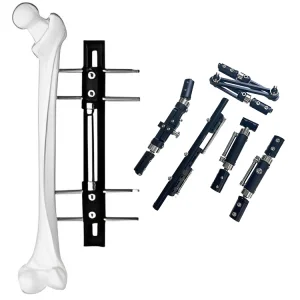 Jakarta Fracture Surgery
