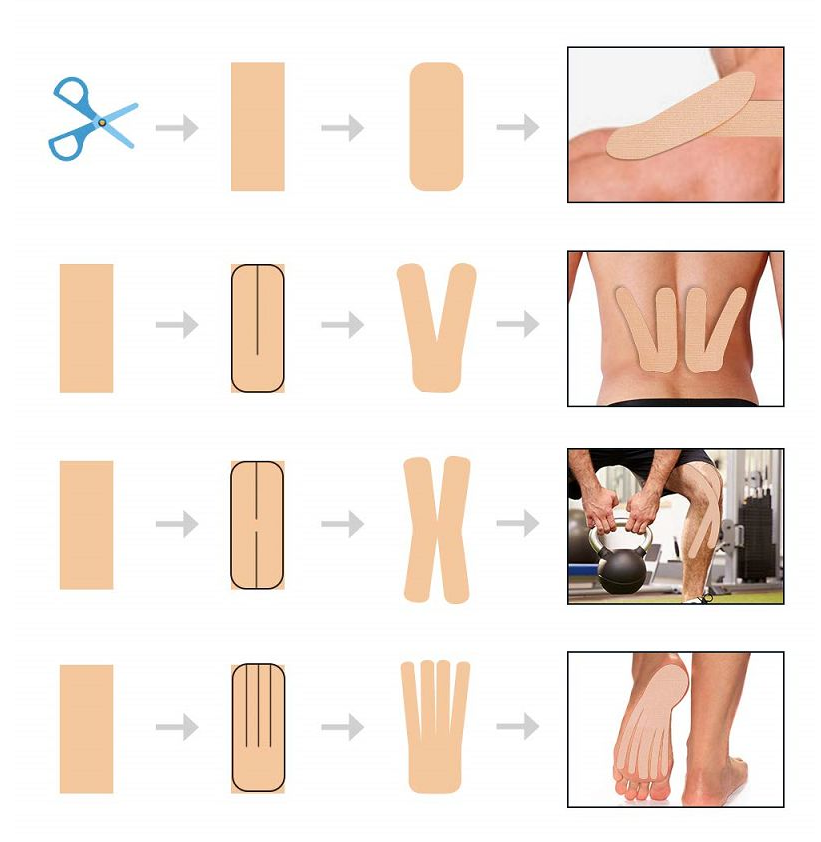 Yueqing NuCure Medical Co., Ltd. — Company Overview