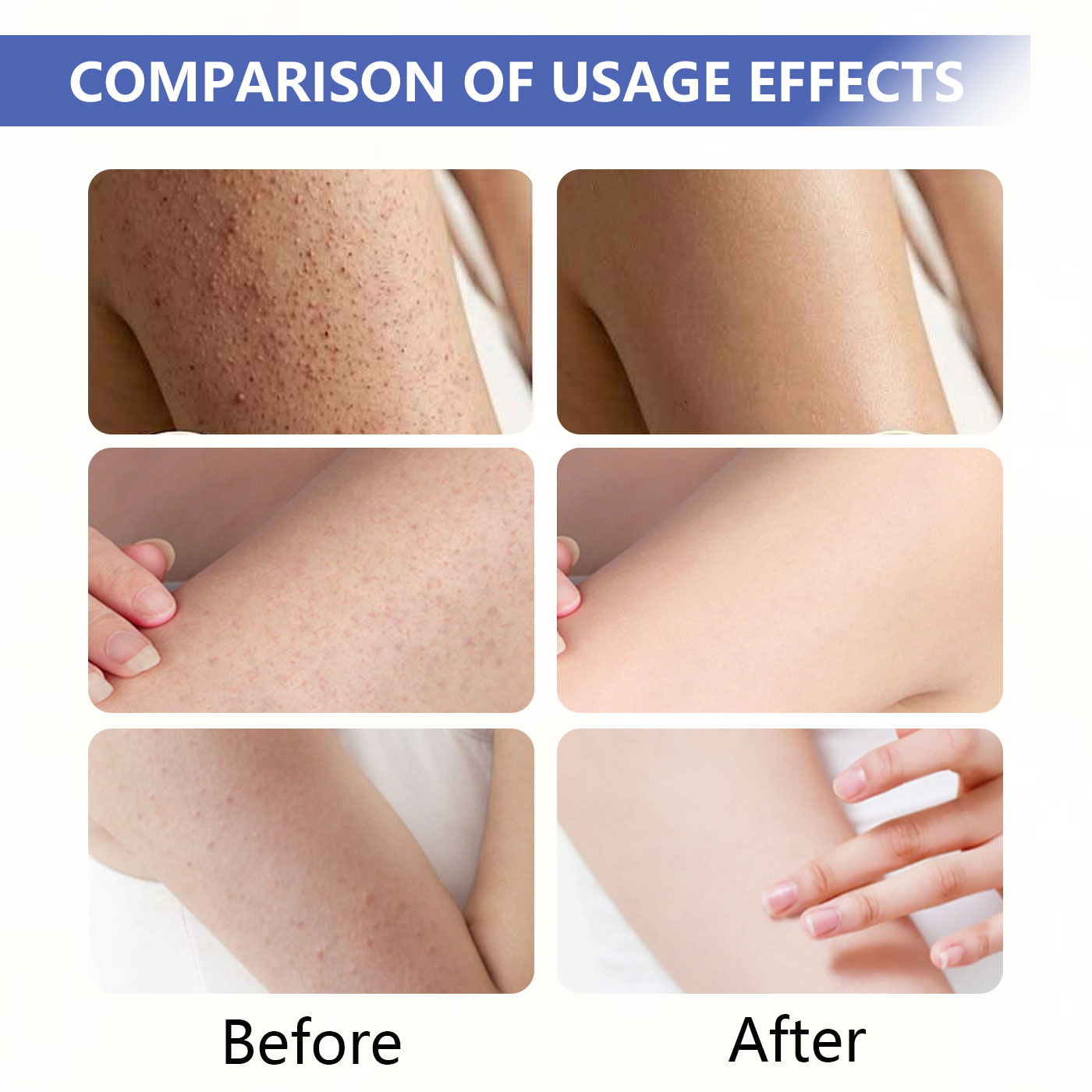 50ml BHA AHA PHA Skin Softener Serum Exfoliate Prevent Ingrown Hairs Softening Serum Soothe &amp; Repair Pdrn Serum