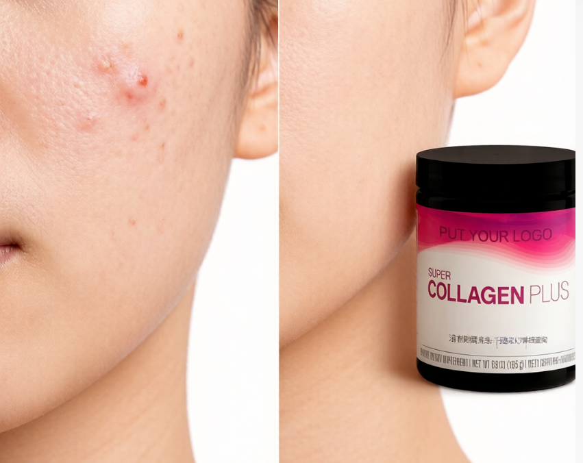 OEM Collagen Powder with Vitamin C and Hyaluronic Acid Private Label Hydrolyzed Collagen Peptides, GMP Certified, Low MOQ