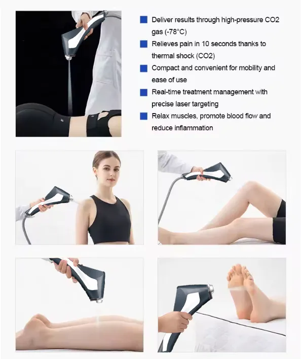 Cryotherapy Treatment