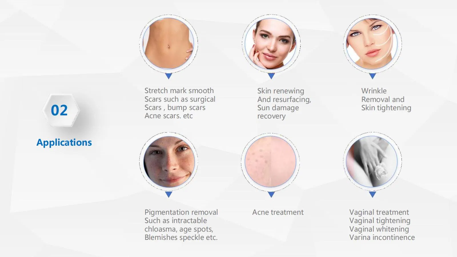 Fractional CO2 Laser for Scar Removal Vaginal Tightening Skin Whiten Wrinkles Removal