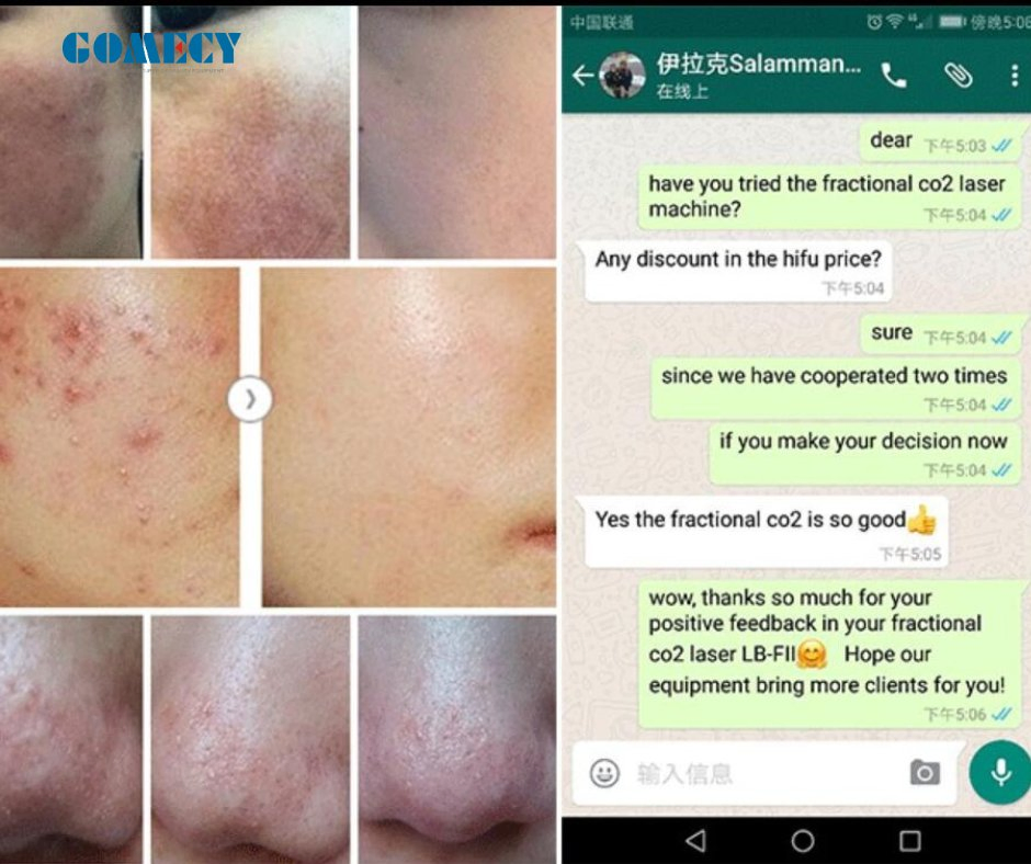 2024 Newest Fractional CO2 Laser for Skin Rejuvenation Anti-Aging Wrinkle Removal Machine