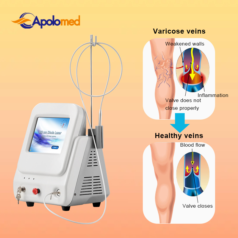 28*27*37cm Carton Packed Blood Vessels Angiotelectasis Spider Veins Treatment Vascular Removal Plant