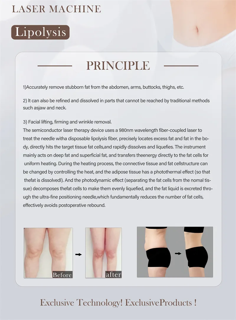 Liposuction Machine Detail