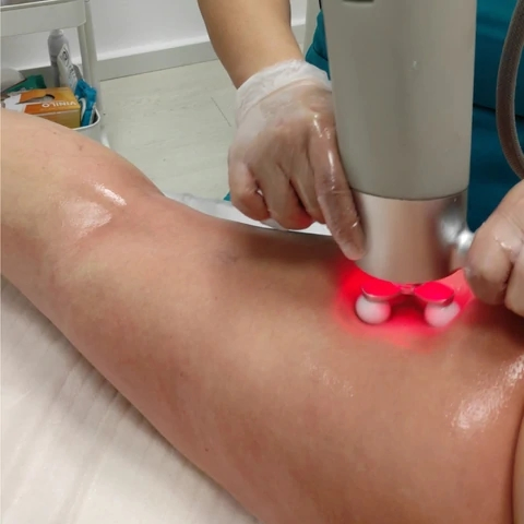 2024 Radio Frequency Acne Scar Stretch Marks Removal Massage Cavitation System RF Roller Slimming Machine